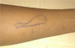 No child should play Blue Whale Game, advises 17 year old survivor